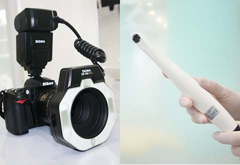 口腔内カメラ（一眼レフ・ペン）