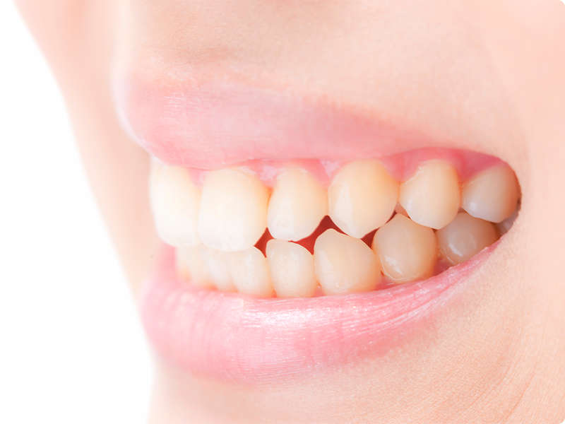 歯ぎしり・食いしばり