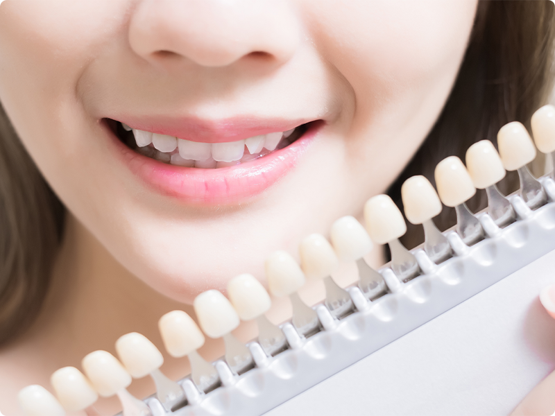 ホワイトニング